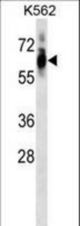 Mouse Cdk8 Antibody western blot of K562 cell line lysates (35 ug/lane). The Cdk8 antibody detected the Cdk8 protein (arrow).