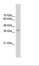 Transfected 293T Cell Lysate