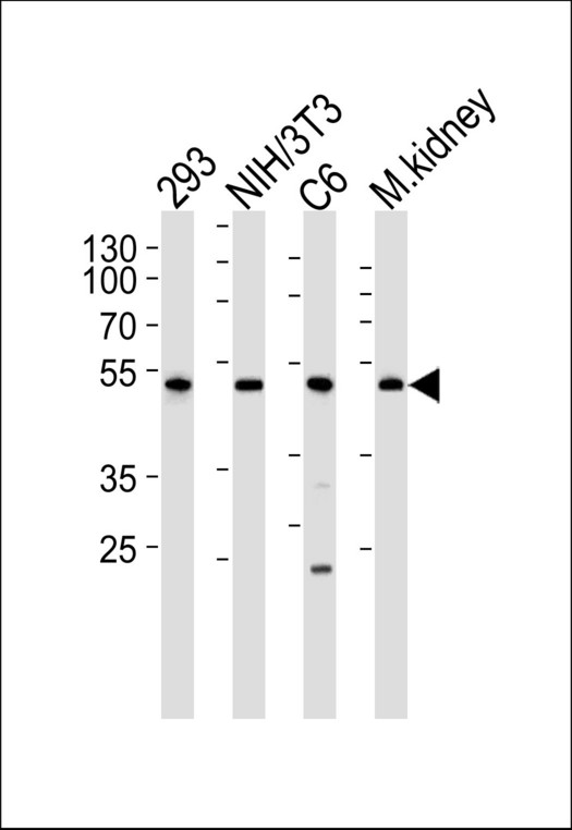 Western blot of lysates from 293, mouse NIH/3T3, rat C6 cell line and mouse kidney tissue lysate(from left to right), using Mouse Cdk9 Antibody. Antibody was diluted at 1:1000 at each lane. A goat anti-rabbit IgG H&L (HRP) at 1:5000 dilution was used as the secondary antibody. Lysates at 35ug per lane.