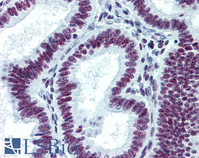 Anti-CDKL1 antibody IHC of human uterus. Immunohistochemistry of formalin-fixed, paraffin-embedded tissue after heat-induced antigen retrieval. Antibody LS-B6189 concentration 5 ug/ml.