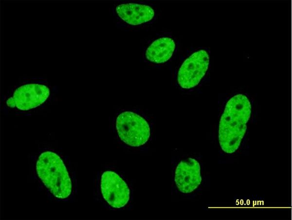 Immunofluorescence of monoclonal antibody to CDKL1 on HeLa cell. [antibody concentration 10 ug/ml].