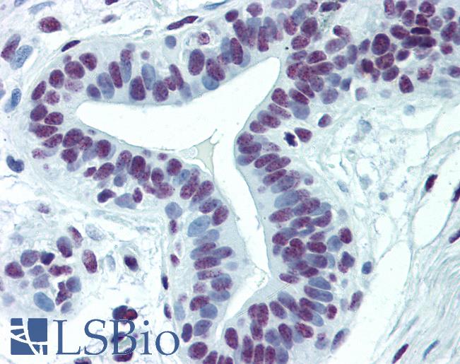 Anti-CDKL1 antibody IHC of human breast. Immunohistochemistry of formalin-fixed, paraffin-embedded tissue after heat-induced antigen retrieval. Antibody LS-B6188 concentration 5 ug/ml.