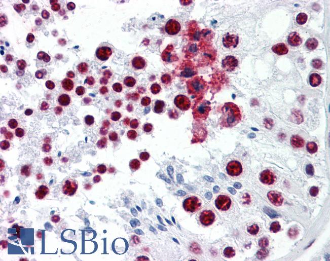 Anti-CDKL1 antibody IHC of human testis. Immunohistochemistry of formalin-fixed, paraffin-embedded tissue after heat-induced antigen retrieval. Antibody LS-B4473 concentration 5 ug/ml.