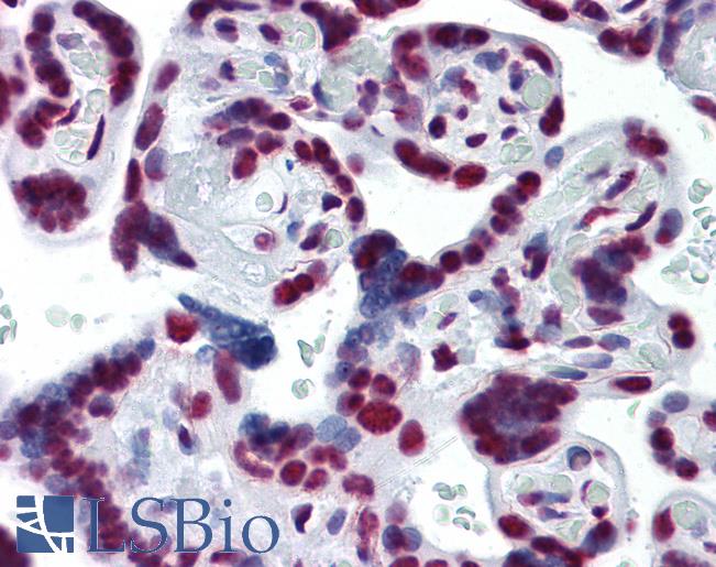 Anti-CDKL1 antibody IHC of human placenta. Immunohistochemistry of formalin-fixed, paraffin-embedded tissue after heat-induced antigen retrieval. Antibody LS-B4473 concentration 5 ug/ml.