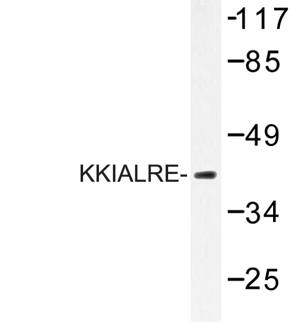 Western blot of KKIALRE (N301)) pAb in extracts from COLO205 cells.