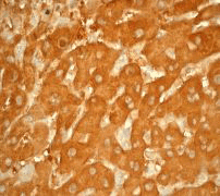 IHC of paraffin-embedded human liver using anti-Aldh1a1 antibody.