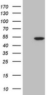 HEK293T cells were transfected with the pCMV6-ENTRY control (Left lane) or pCMV6-ENTRY CDKL1 (Right lane) cDNA for 48 hrs and lysed. Equivalent amounts of cell lysates (5 ug per lane) were separated by SDS-PAGE and immunoblotted with anti-CDKL1.