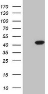 HEK293T cells were transfected with the pCMV6-ENTRY control (Left lane) or pCMV6-ENTRY CDKL1 (Right lane) cDNA for 48 hrs and lysed. Equivalent amounts of cell lysates (5 ug per lane) were separated by SDS-PAGE and immunoblotted with anti-CDKL1.