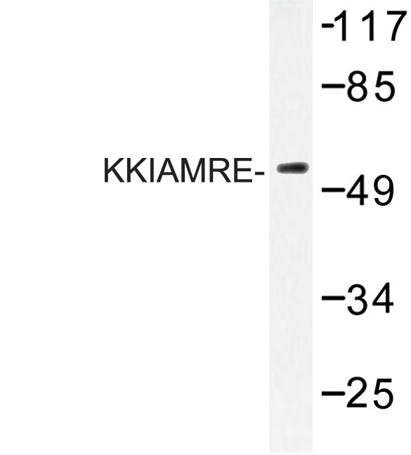 Western blot of KKIAMRE (L240) pAb in extracts from Jurkat cells.