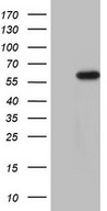 HEK293T cells were transfected with the pCMV6-ENTRY control (Left lane) or pCMV6-ENTRY CDKL2 (Right lane) cDNA for 48 hrs and lysed. Equivalent amounts of cell lysates (5 ug per lane) were separated by SDS-PAGE and immunoblotted with anti-CDKL2.