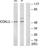 Western blot of extracts from Jurkat/293 cells, using CDKL2 Antibody. The lane on the right is treated with the synthesized peptide.