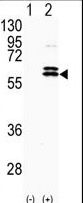 Western blot of CDKL2 (arrow) using rabbit polyclonal CDKL2 Antibody. 293 cell lysates (2 ug/lane) either nontransfected (Lane 1) or transiently transfected with the CDKL2 gene (Lane 2) (Origene Technologies).