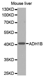 Western blot analysis of extracts of mouse liver cells lines, using ADH1B antibody.