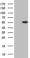 HEK293T cells were transfected with the pCMV6-ENTRY control (Left lane) or pCMV6-ENTRY CDKL2 (Right lane) cDNA for 48 hrs and lysed. Equivalent amounts of cell lysates (5 ug per lane) were separated by SDS-PAGE and immunoblotted with anti-CDKL2.