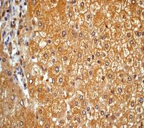 IHC of paraffin-embedded human liver using anti-Aldh1a1 antibody.