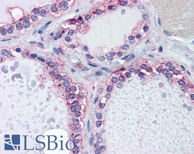 Anti-CDKL2 antibody IHC of human thyroid. Immunohistochemistry of formalin-fixed, paraffin-embedded tissue after heat-induced antigen retrieval. Antibody LS-B4479 concentration 5 ug/ml.