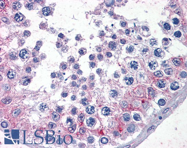 Anti-CDKL2 antibody IHC of human testis. Immunohistochemistry of formalin-fixed, paraffin-embedded tissue after heat-induced antigen retrieval. Antibody LS-B4479 concentration 5 ug/ml.