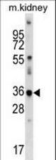 Mouse Cdkl4 Antibody western blot of mouse kidney tissue lysates (35 ug/lane). The Cdkl4 antibody detected the Cdkl4 protein (arrow).