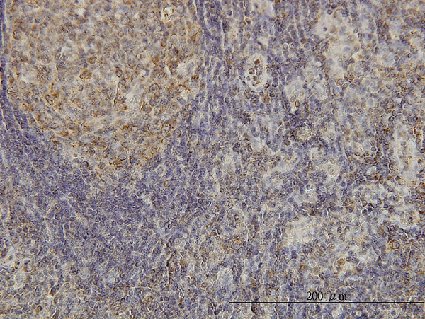 Immunoperoxidase of monoclonal antibody to CDKL4 on formalin-fixed paraffin-embedded human lymph node. [antibody concentration 3 ug/ml]