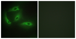 Immunofluorescence of HeLa cells, using CDKL4 Antibody. The picture on the right is treated with the synthesized peptide.
