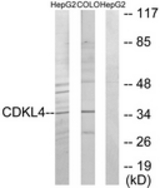 Western blot of extracts from HepG2/COLO205 cells, using CDKL4 Antibody. The lane on the right is treated with the synthesized peptide.