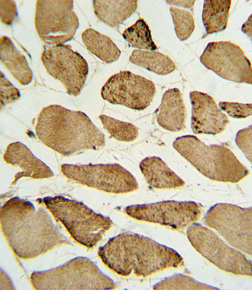 Formalin-fixed and paraffin-embedded human skeletal muscle with Phospho-p27Kip1-S10 Antibody, which was peroxidase-conjugated to the secondary antibody, followed by DAB staining. This data demonstrates the use of this antibody for immunohistochemistry; clinical relevance has not been evaluated.