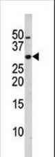 The anti-Phospho-p27Kip1-S10 antibody is used in Western blot to detect Phospho-p27Kip1-S10 in HL60 tissue lysate
