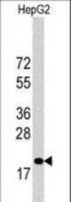Western blot of p27Kip1 Antibody in HepG2 cell line lysates (35 ug/lane). 27Kip1(arrow) was detected using the purified antibody.