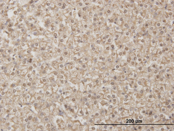 Immunoperoxidase of monoclonal antibody to ADH4 on formalin-fixed paraffin-embedded human liver. [antibody concentration 3 ug/ml]