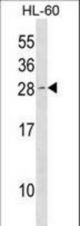 Mouse Cdkn1b Antibody western blot of HL-60 cell line lysates (35 ug/lane). The Mouse Cdkn1b antibody detected the Mouse Cdkn1b protein (arrow).