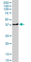 ADH4 monoclonal antibody (M03), clone 1D2. Western blot of ADH4 expression in human liver.