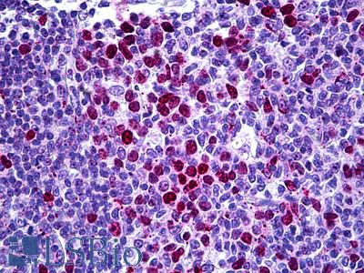 Anti-CDKN1B / p27 Kip1 antibody IHC of human tonsil. Immunohistochemistry of formalin-fixed, paraffin-embedded tissue after heat-induced antigen retrieval. Antibody LS-B5740 concentration 5 ug/ml.