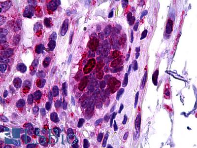 Anti-CDKN1B / p27 Kip1 antibody IHC of human intestine. Immunohistochemistry of formalin-fixed, paraffin-embedded tissue after heat-induced antigen retrieval. Antibody LS-B5740 concentration 5 ug/ml.