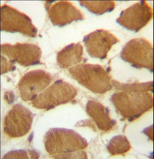 CDKN1B Antibody immunohistochemistry of formalin-fixed and paraffin-embedded human skeletal muscle followed by peroxidase-conjugated secondary antibody and DAB staining.