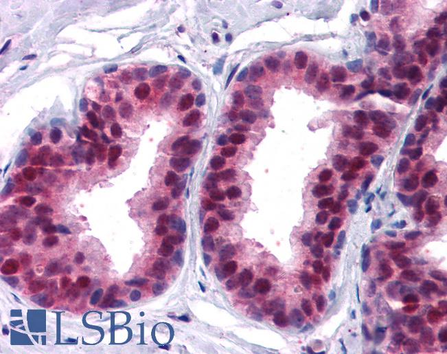 Anti-CDKN1B / p27 Kip1 antibody IHC of human prostate. Immunohistochemistry of formalin-fixed, paraffin-embedded tissue after heat-induced antigen retrieval. Antibody LS-B3943 concentration 5 ug/ml.