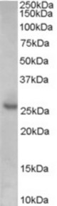Antibody (0.1 ug/ml) staining of Human Prostate lysate (35 ug protein in RIPA buffer). Primary incubation was 1 hour. Detected by chemiluminescence.