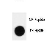 Dot blot of anti-Phospho-p27Kip1-T198 Antibody on nitrocellulose membrane. 50ng of Phospho-peptide or Non Phospho-peptide per dot were adsorbed. Antibody working concentrations are 0.5ug per ml.