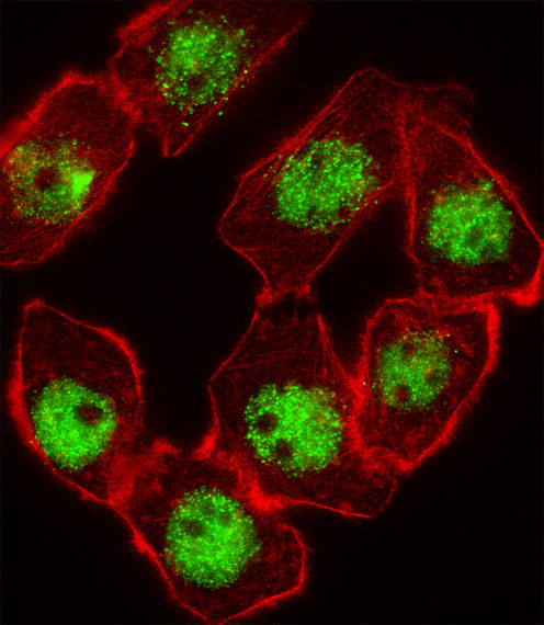 Fluorescent image of A549 cell stained with CDKN1C Antibody. A549 cells were fixed with 4% PFA (20 min), permeabilized with Triton X-100 (0.1%, 10 min), then incubated with CDKN1C primary antibody (1:25, 1 h at 37°C). For secondary antibody, Alexa Fluor 488 conjugated donkey anti-rabbit antibody (green) was used (1:400, 50 min at 37°C). Cytoplasmic actin was counterstained with Alexa Fluor 555 (red) conjugated Phalloidin (7units/ml, 1 h at 37°C). CDKN1C immunoreactivity is localized to Nucleus significantly.