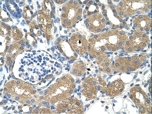 Immunohistochemistry with Fetal liver cell lysate tissue at an antibody concentration of 1.25 ug/ml using anti-ADH4 antibody.
