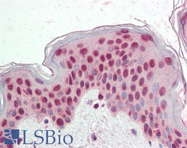 Anti-CDKN1C / p57 KIP2 antibody IHC staining of human skin. Immunohistochemistry of formalin-fixed, paraffin-embedded tissue after heat-induced antigen retrieval.