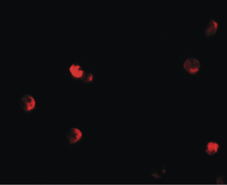 Immunofluorescence of CDKN1C in 293 cells with CDKN1C antibody at 20 ug/ml.