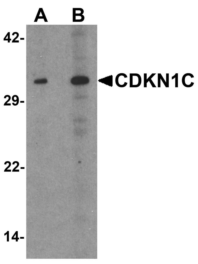 Western blot analysis of CDKN1C in 293 cell lysate with CDKN1C antibody at (A) 1 and (B) 2 ug/ml.
