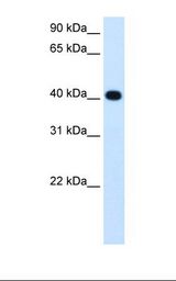 Fetal liver cell lysate. Antibody concentration: 1.25 ug/ml. Gel concentration: 12%.