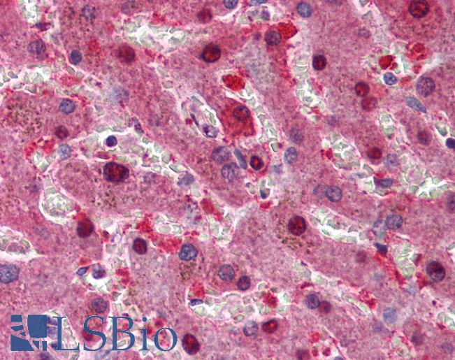 Anti-p16INK4A antibody IHC of human liver. Immunohistochemistry of formalin-fixed, paraffin-embedded tissue after heat-induced antigen retrieval. Antibody LS-B193 concentration 5 ug/ml.