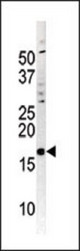 The anti-Phospho-p16-INK4A-S152 antibody is used in Western blot to detect Phospho-p16-INK4A-S152 in A2058 tissue lysate