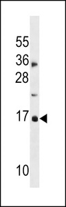 hp16-INK4A Antibody (S7) western blot of MDA-MB453 cell line lysates (35 ug/lane). The CDKN2A antibody detected the CDKN2A protein (arrow).