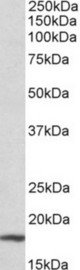CDKN2A/p19ARF antibody (0.3 ug/ml) staining of Mouse Liver lysate (35 ug protein in RIPA buffer). Primary incubation was 1 hour. Detected by chemiluminescence.