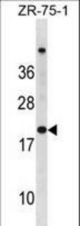 CDKN2A Antibody (N-term S8) western blot of ZR-75-1 cell line lysates (35 ug/lane). The CDKN2A antibody detected the CDKN2A protein (arrow).