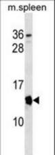 Mouse Cdkn2a Antibody western blot of mouse spleen tissue lysates (35 ug/lane). The Cdkn2a antibody detected the Cdkn2a protein (arrow).