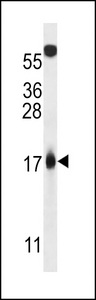 MLM Antibody western blot of 293 cell line lysates (35 ug/lane). The MLM antibody detected the MLM protein (arrow).
